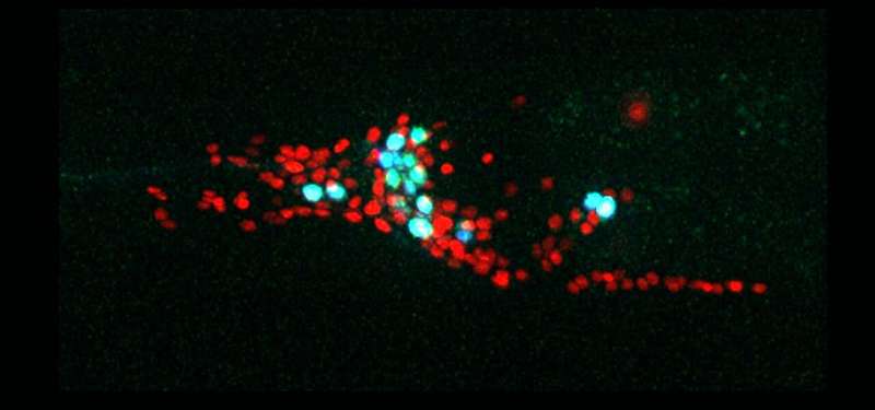 "Noisy" roundworm brains give rise to individuality