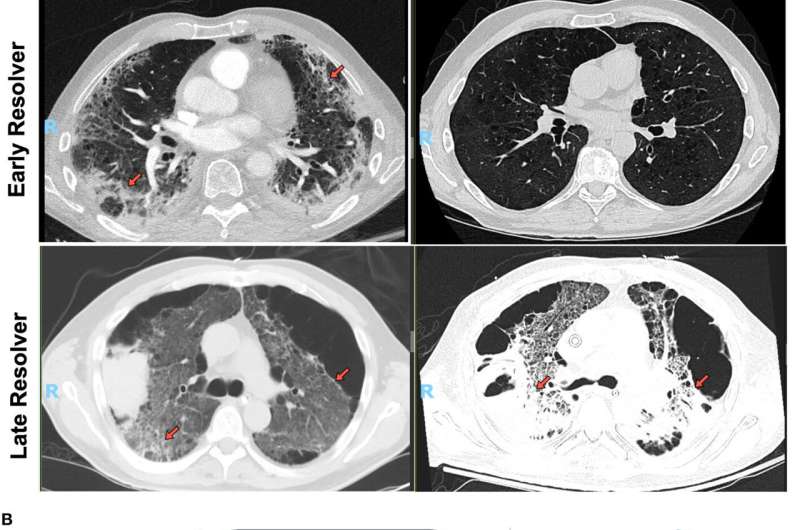 Simple blood test could predict risk of long-term COVID-19 lung problems 