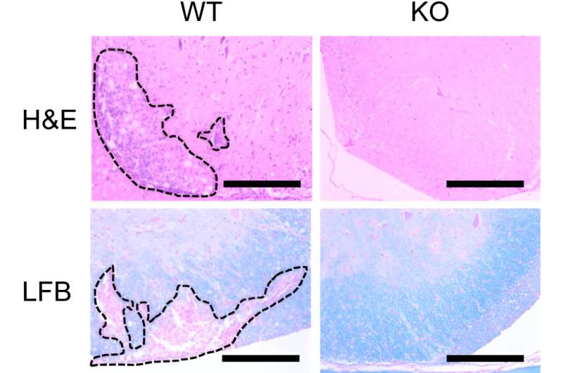 Key protein linked to immune disorders