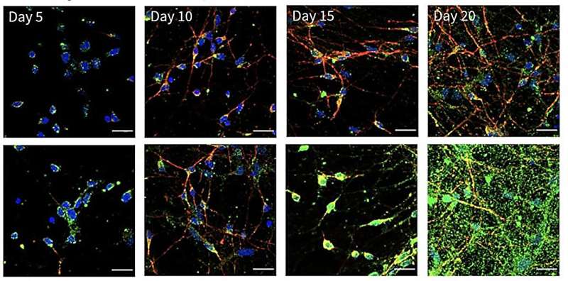 Why is the brain so prone to inflammation?