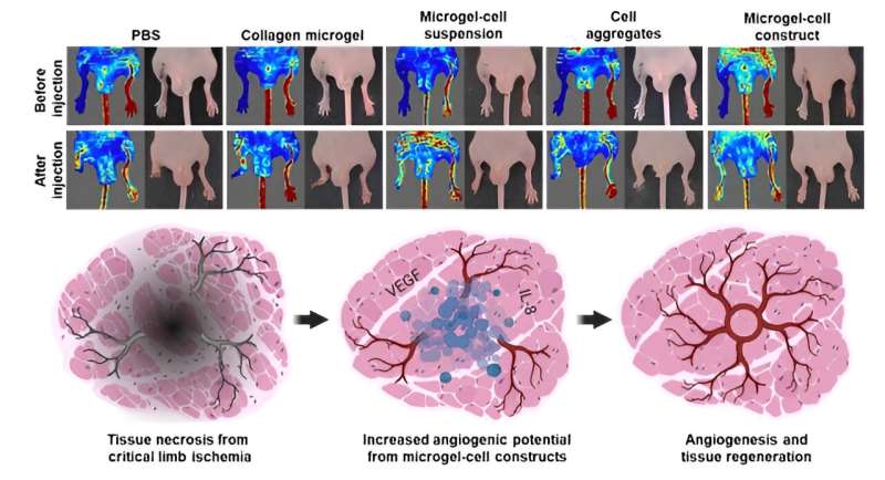 Developing a stem cell therapy to prevent amputations from critical limb ischemia