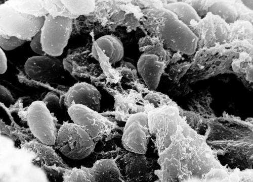 Bubonic plague kills New Mexico man, officials say: What to know about the 'Black Death' 