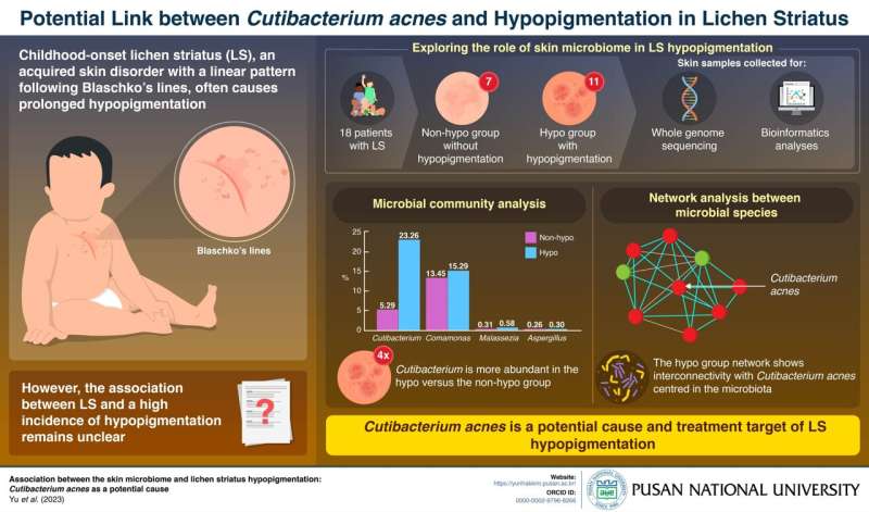 Researchers reveal Cutibacterium acnes as a potential cause of lichen striatus hypopigmentation 