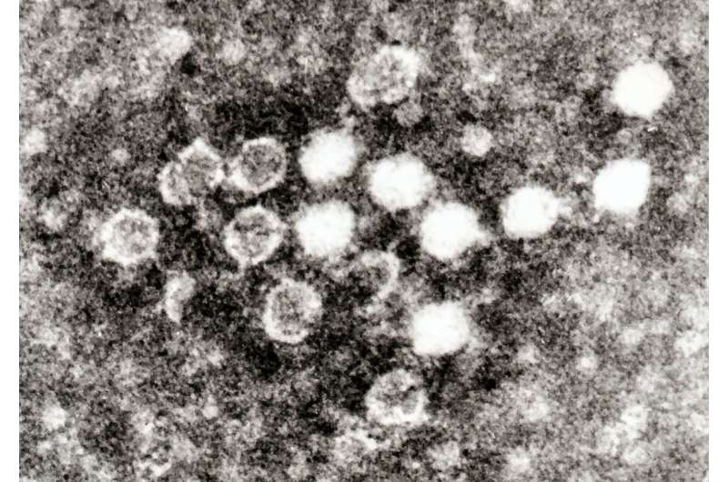 Parvovirus B19