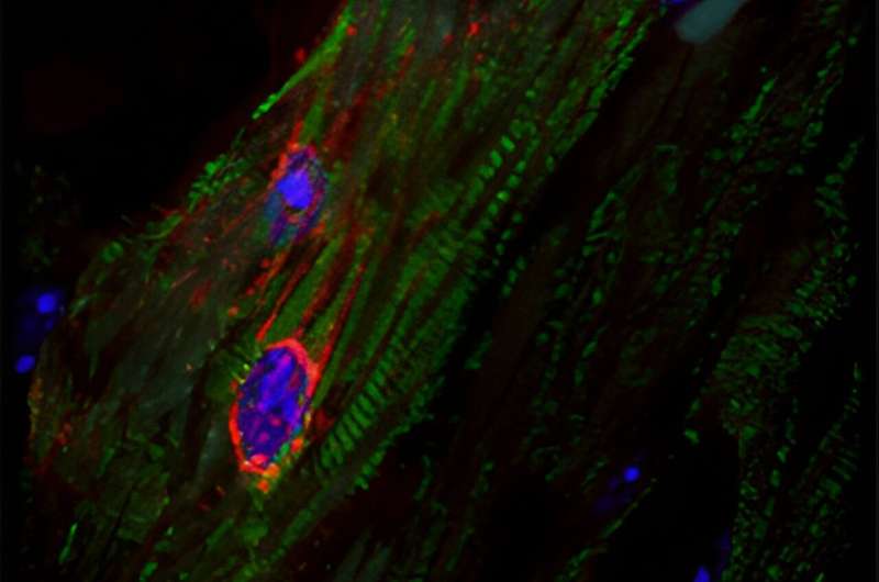 Characteristic stripes (green) make the heart muscle cell (cardiomyocyte) easily recognizable. The virus infection in this cell is shown by viral RNA which has been colored red. Image: Freiburg University Medical Centre. Credit: Hanna Wolf, AG Lindner, Department of Cardiology and Angiology