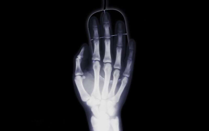 x-ray hand