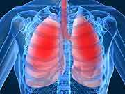 High false negative rate with PFTs in scleroderma lung disease 