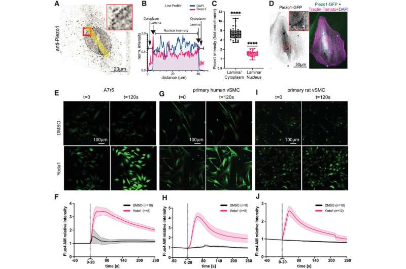 Chronic Yoda1 treatment supports transition to a foam cell phenotype. A-B) Wound scratch assay shows reduced migration of Yoda1 treated A7r5 cells. C) Nanoindentation indicates a lower Young's Modulus after Yoda1 treatment. D,E) Click-EdU assay indicates higher cell proliferation following Yoda1 incubation, which is reversed after simultaneous Dooku1 treatment. F,G) TUNEL staining indicates no significant changes to apoptosis after 8&nbsp;h Yoda1 treatment. H–L). qPCR testing indicate increased CD68 (H), KLF4 (I), LDLR (J) and lower ABCA1 (K) transcription after 8-hour Yoda1 treatment, while LGALS3 (L) showed no change at this time point. p-values from unpaired two-tailed t-tests (B,C, H–L), or one-way ANOVA with Tukey correction for multiple comparisons (E,G): * p&lt;0.0332, ** p&lt;0.0021, *** p&lt;0.0002. Credit: Advanced Science (2023). DOI: 10.1002/advs.202308686