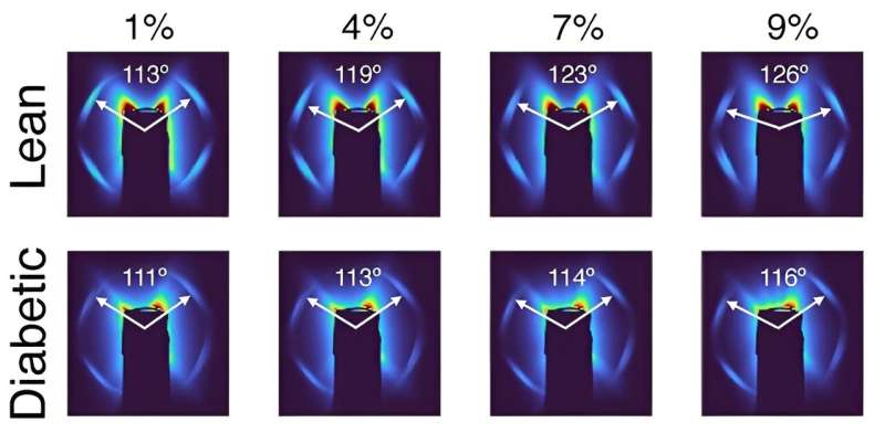 Comparison of X-ray scattering patterns between a representative disc from each group showing the relative peak positions at various amounts of disc compression. Applied compressive strains and interlamellar fiber angles are shown. Credit: University of California/University of Utah