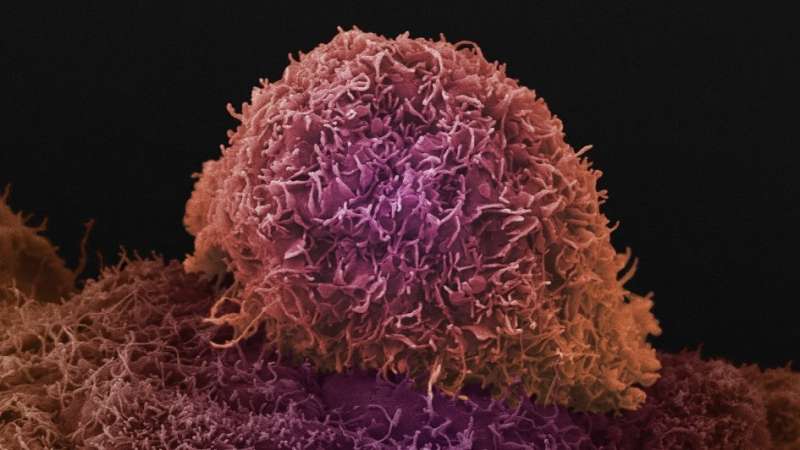 New type of treatment could reawaken immune response against prostate cancer 