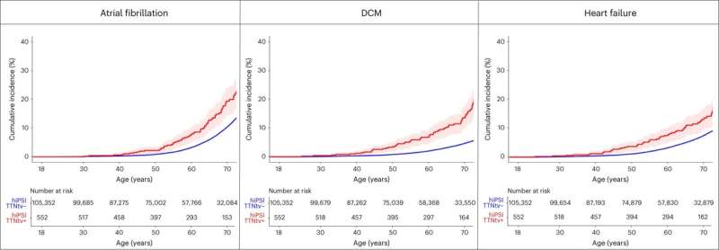 Black individuals with a genetic mutation have increased risk of developing atrial fibrillation, heart failure 