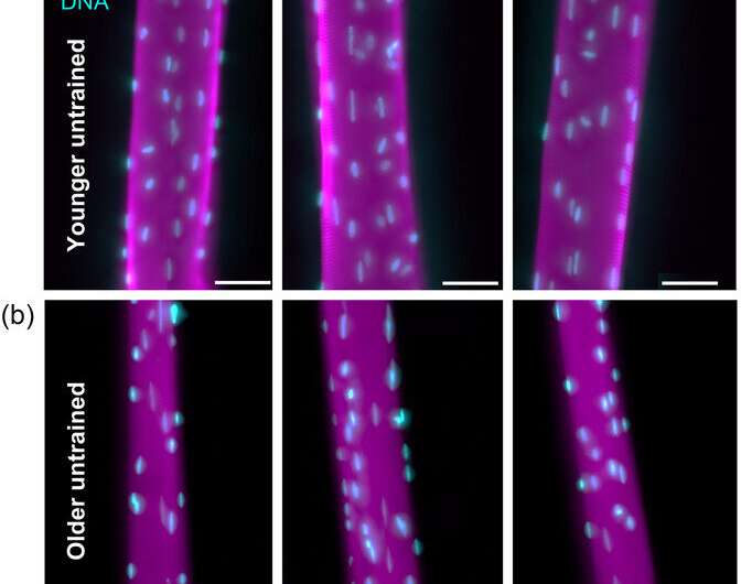 Muscle health may be informed by activity level rather than aging process