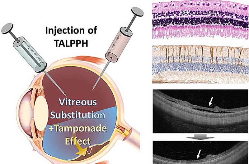 Treatment for blindness-causing retinal detachment using viscous seaweed