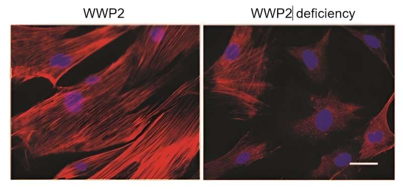 Duke-NUS scientists discover "powerhouse" gene, opening doors to new treatments for kidney disease