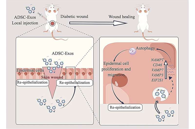 Stem cell 'messages' fast-track healing of diabetic wounds