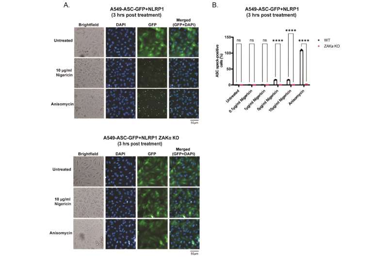 How the body's immune response to bacterial infections could cause detrimental inflammation