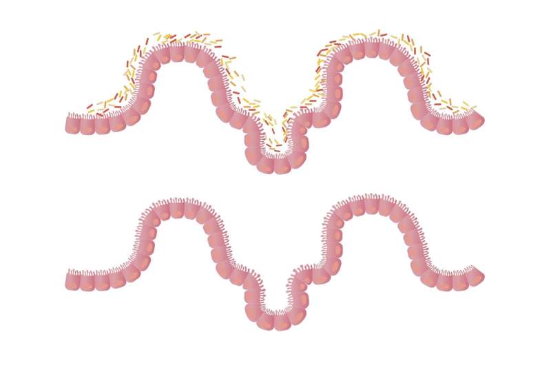 Gut microbiome: Meet Roseburia intestinalis—the energy-producing bacterium that helps us fight against disease