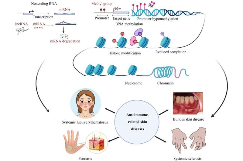 Epigenetics is of critical importance in autoimmune-related skin diseases