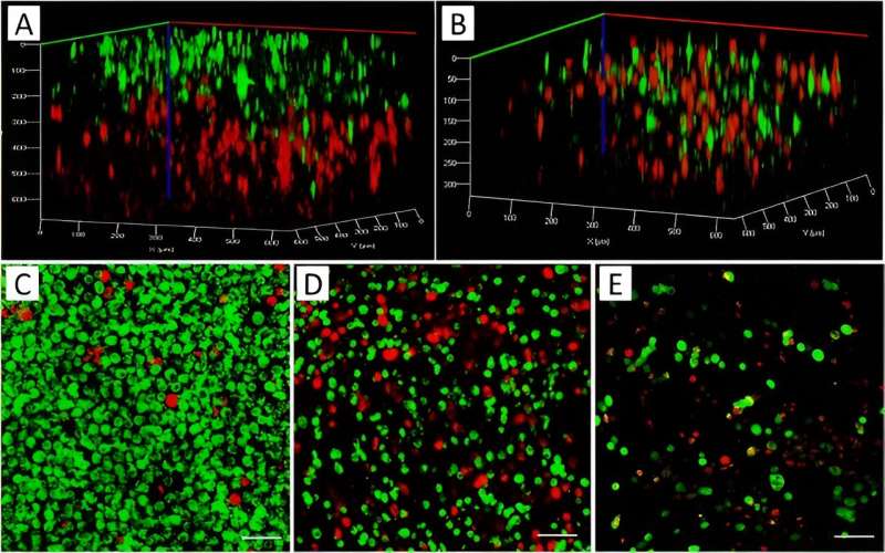 A 3-D bioprinted tumor-on-a-chip model