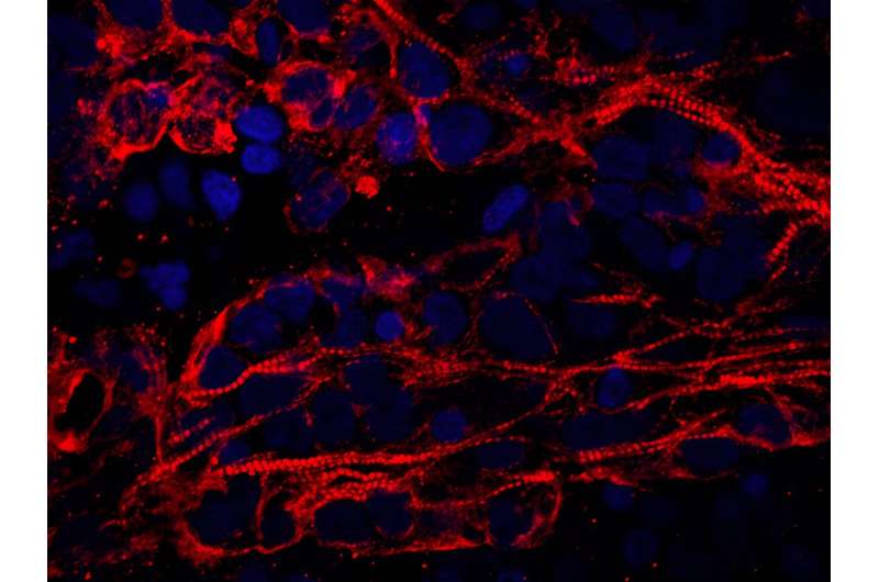 Heart organoids simulate pregestational diabetes-induced congenital heart disease 