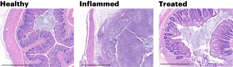 Empowering mucosal healing with an engineered probiotic