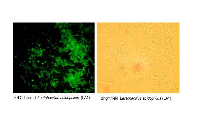 Probiotic Lactobacillus acidophilus shows promise for treating inflammatory bowel disease and other conditions 