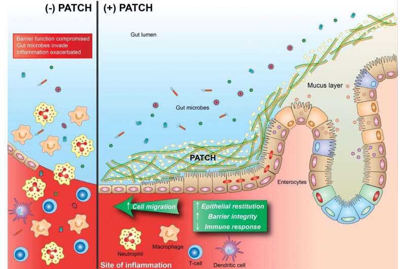 Empowering mucosal healing with an engineered probiotic 