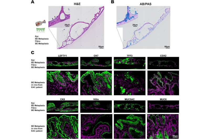 Barrett's esophagus modeled in a human organ chip 