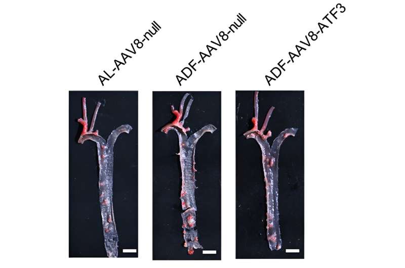 Chinese scientists provide novel insights into the effects of alternate day fasting on atherosclerosis