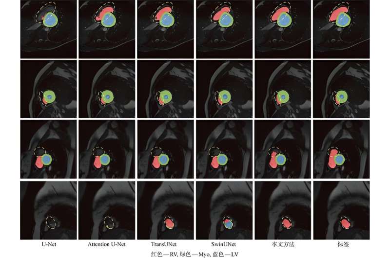 Visual comparison of cardiac segmentation results of different methods. Credit: Journal of Shanghai Jiao Tong University(2023). DOI: 10.16183/j.cnki.jsjtu.2022.088