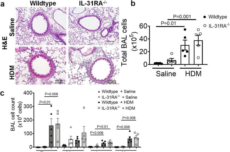 Loss of IL31RA has no effect on house dust mite (HDM)-induced airway inflammation and goblet cell hyperplasia. Credit: Nature Communications (2023). DOI: 10.1038/s41467-023-44040-1