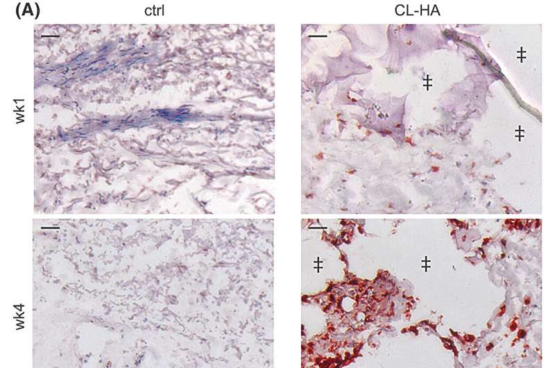 Increased fibroblast synthetic activity as early as 1 week post-filler injection. Following injection of vehicle (saline) and filler (cross-linked hyaluronic acid, CL-HA) into photodamaged skin of individuals over 60 years-old, skin samples were obtained in a paired manner at 1, 2, 3 and 4 weeks. Credit: Experimental Dermatology (2024). DOI: 10.1111/exd.14998