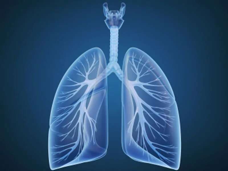 AI model uses serial imaging to predict lung cancer tx response