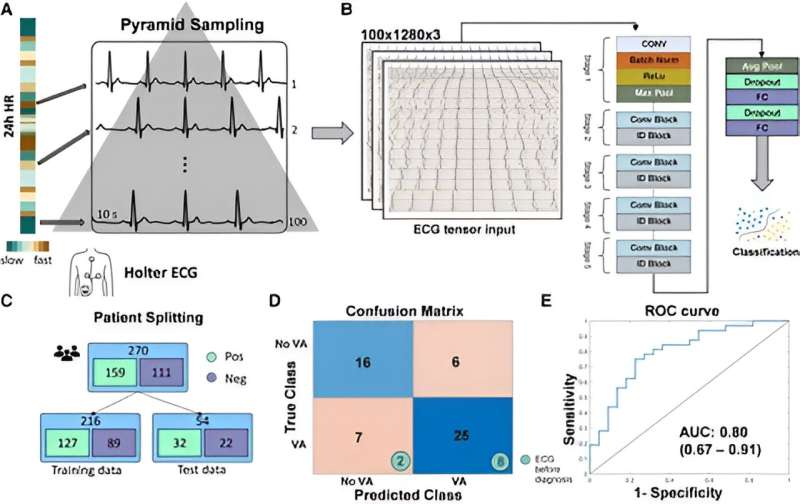 Artificial Intelligence tool successfully predicts fatal heart rhythm