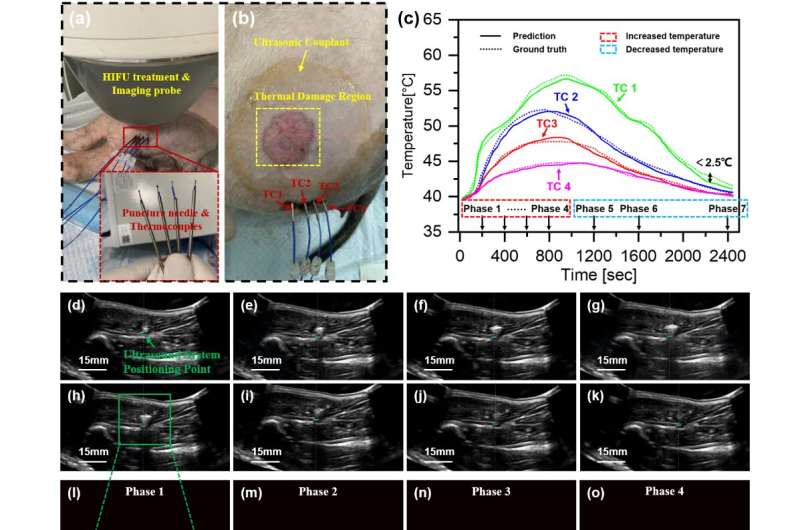 Real-time reconstruction of HIFU focal temperature field based on deep learning