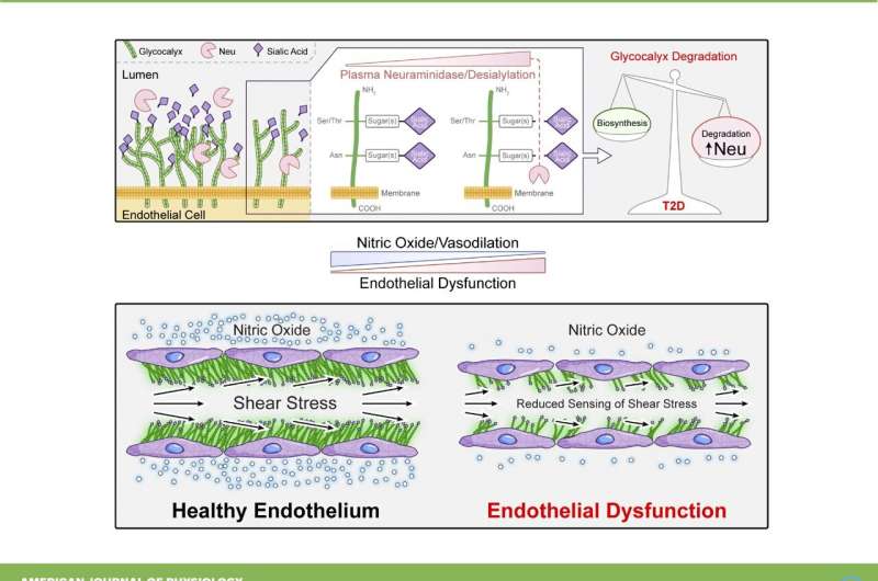 Researchers uncover potential treatment for cardiovascular complications from type 2 diabetes 