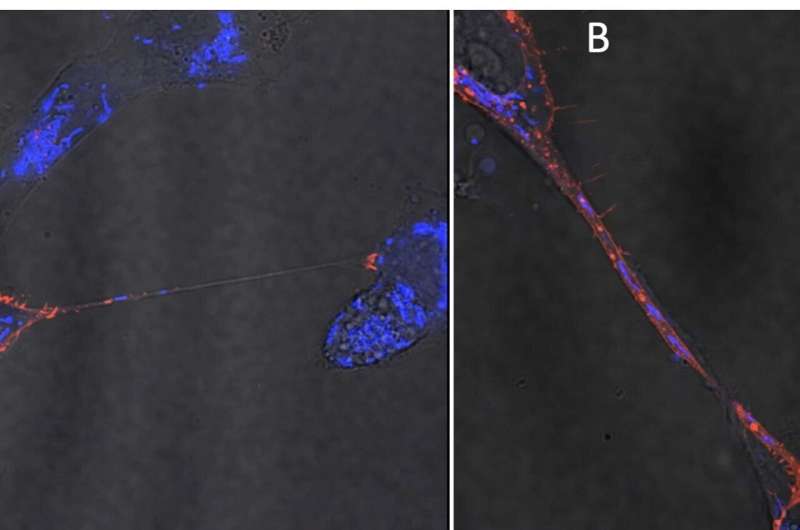 Researchers found that Zika virus induces cells to create connections, called tunneling nanotubes, that may enable the virus to replicate and spread from mother to fetus. Credit: Joyce Jose/Penn State