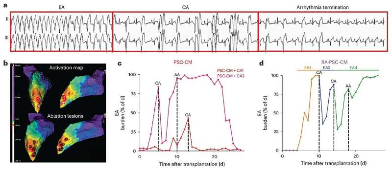 Treating and preventing abnormal heart beats with stem cell muscle grafts 