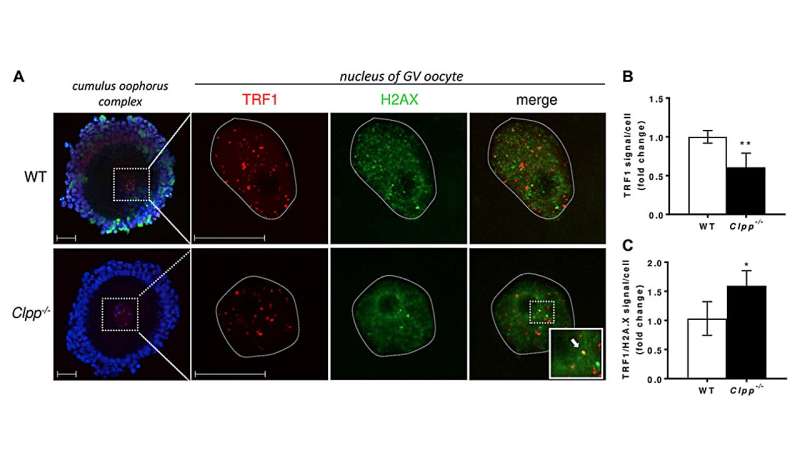 Representative confocal images of TRF1 expression and TRF/H2AX co-localization in cumulus oophorus isolated from 6-month-old wild-type and Clpp−/− mice. Credit: Aging (2024). DOI: 10.18632/aging.205543