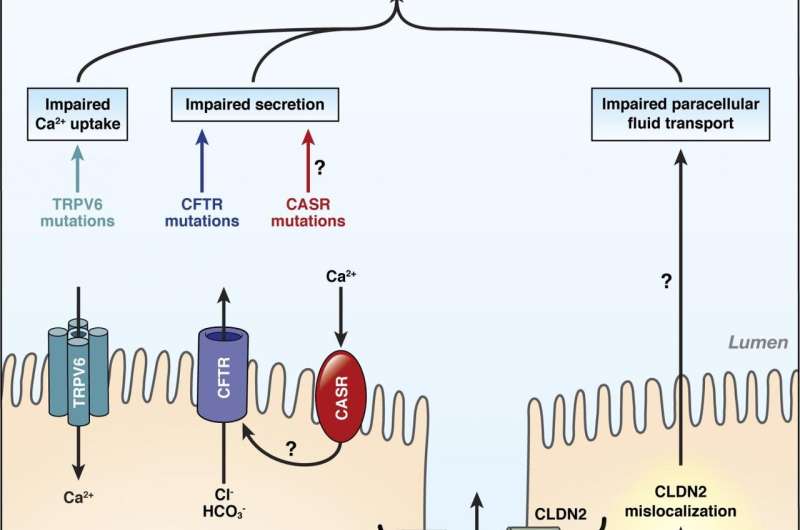 A disease trigger for pancreatitis has been identified