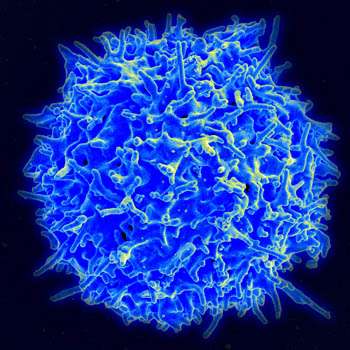 Discovery of stem-like T cell in type 1 diabetes can potentially improve cancer immunotherapy 