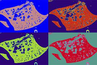 RethiNKing which immune cells are the best weapon against lung cancer