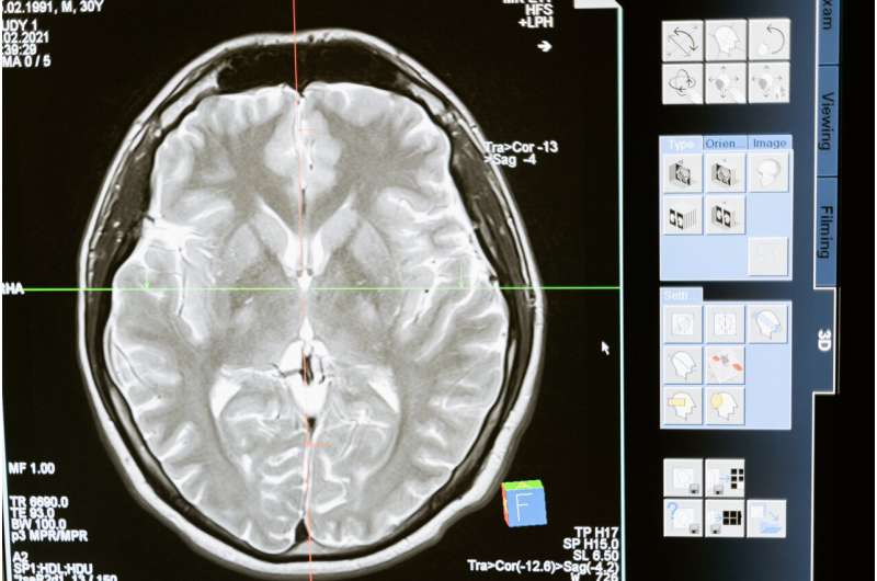 Metabolism linked to brain health