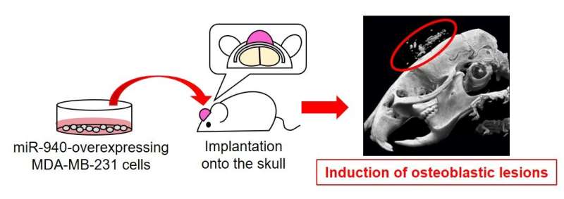 Metastatic cancer cells modify bone remodeling with small RNA secretion in bone metastasis