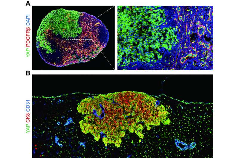 How do metastatic tumor cells grow in lymph nodes?