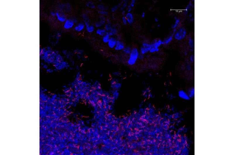 Researchers examine how microbes in the gut process the plant-based, sulfur-containing sugar sulfoquinovose 