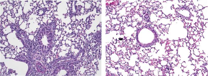 Researchers identify new way to inhibit immune cells that drive allergic asthma