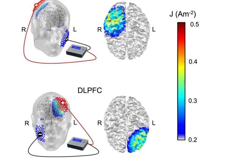 Study questions effectiveness of brain stimulation for memory enhancement