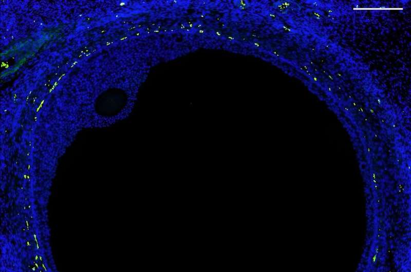 First atlas of the human ovary with cell-level resolution is a step toward artificial ovary