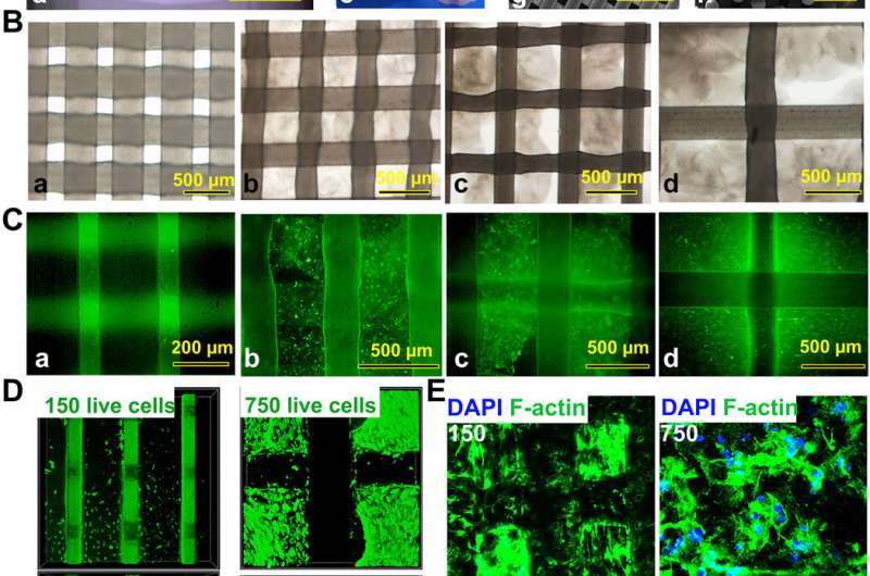 3-D bioprinting constructs for cartilage regeneration